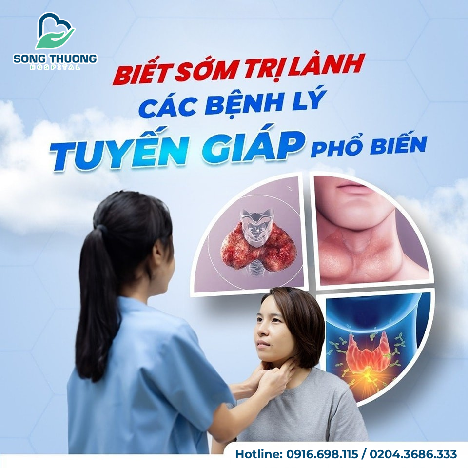 💢 RỦI RO THẦM LẶNG TỪ CÁC BỆNH LÝ TUYẾN GIÁP PHỔ BIẾN